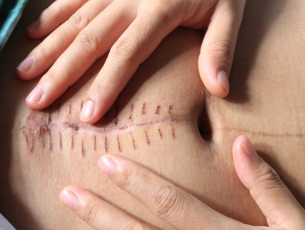 Itb szkolenie Warszawa jako istotny element współczesnej praktyki z pacjentem